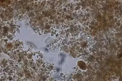 LC-AnDeN氨氧化生物脱氮技术