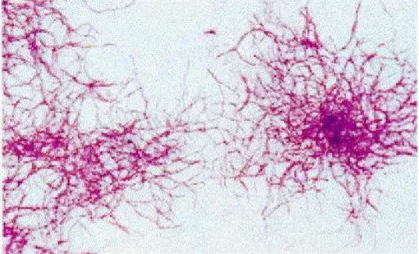 低温环境下怎样提升脱氮除磷效果？