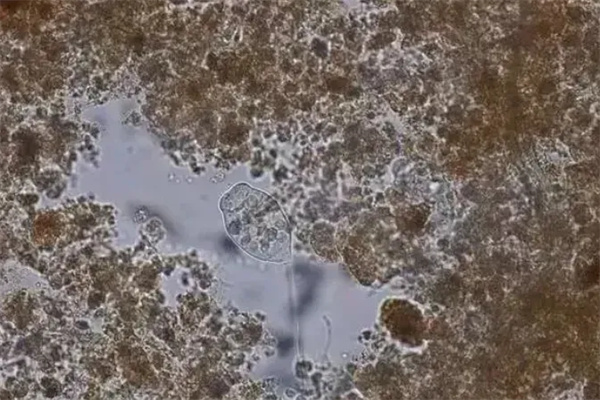 低温环境下怎样提升脱氮除磷效果？